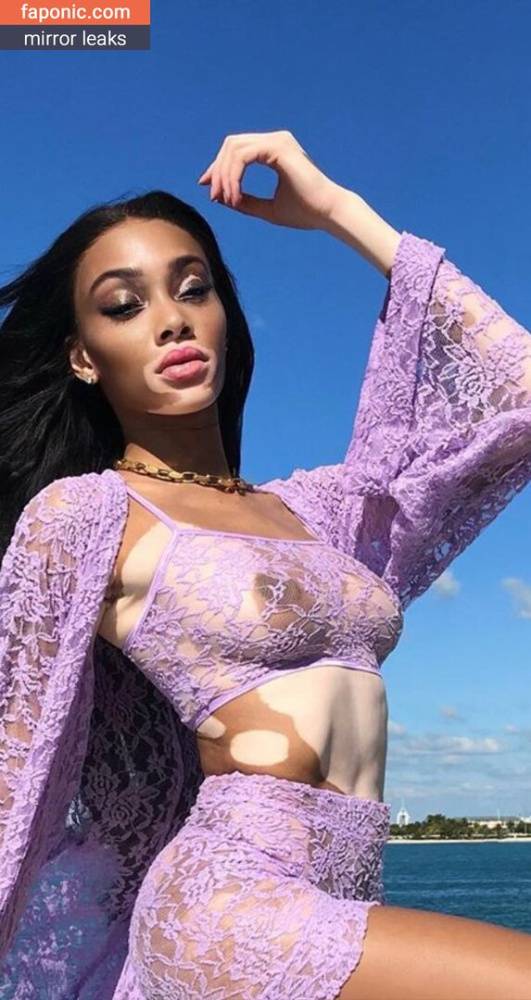 Winnie Harlow aka winnieharlow Nude Leaks - #7