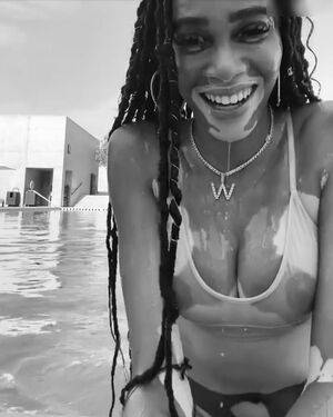 Winnie Harlow / winnieharlow Nude Leaks - Fapello - #18