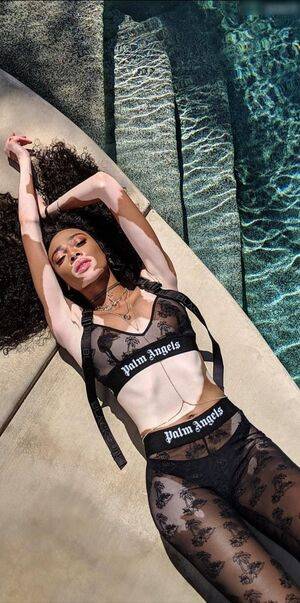 Winnie Harlow / winnieharlow Nude Leaks - Fapello - #15