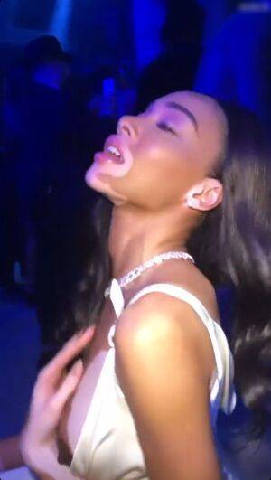 Winnie Harlow / winnieharlow Nude Leaks - Fapello - #22