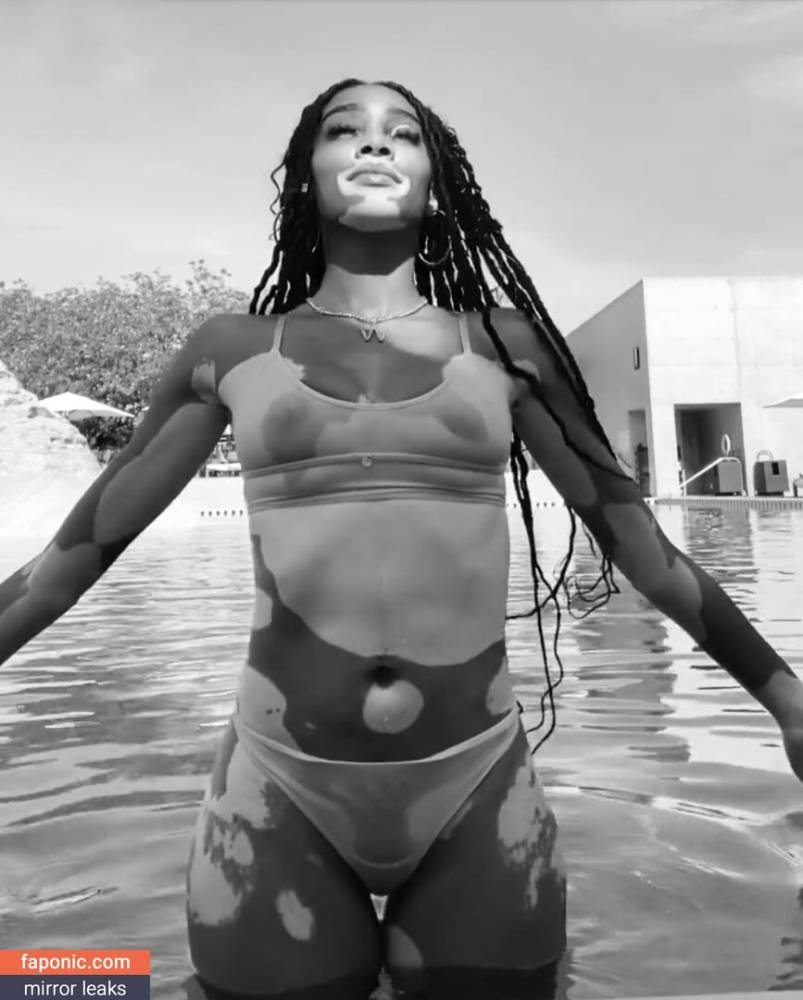 Winnie Harlow aka winnieharlow Nude Leaks - #main